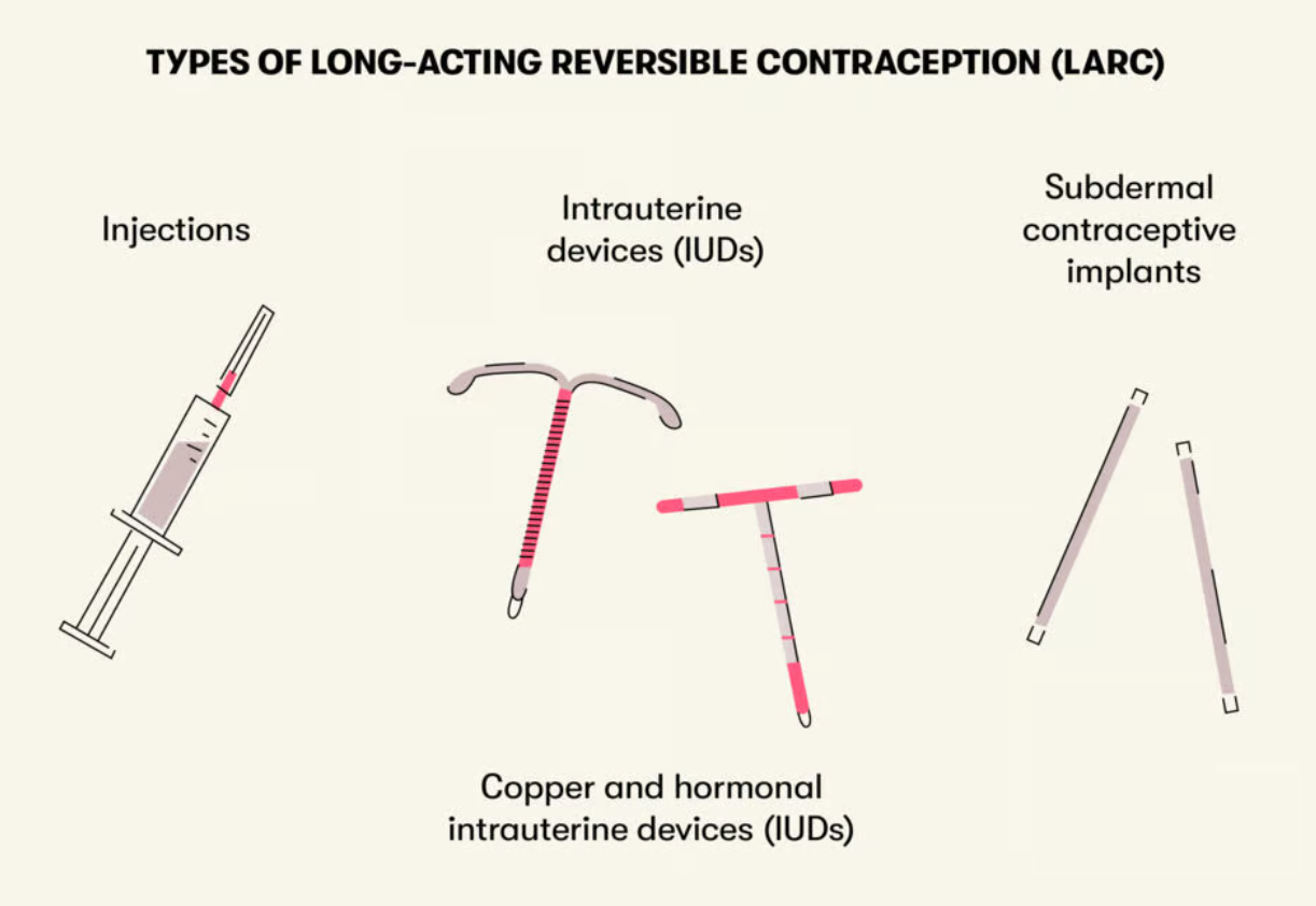 Long-acting reversible contraception image